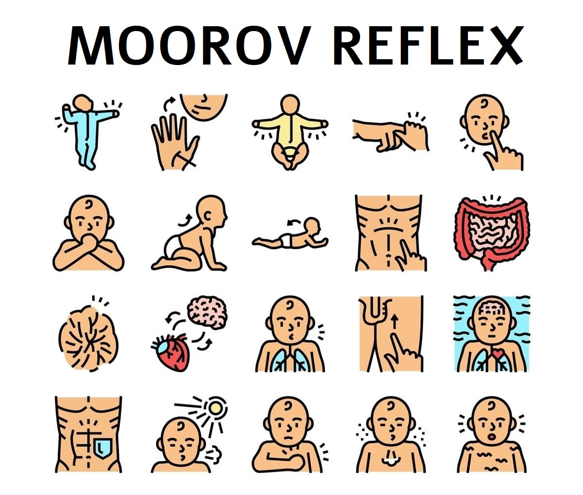 Moorov reflex príznaky
