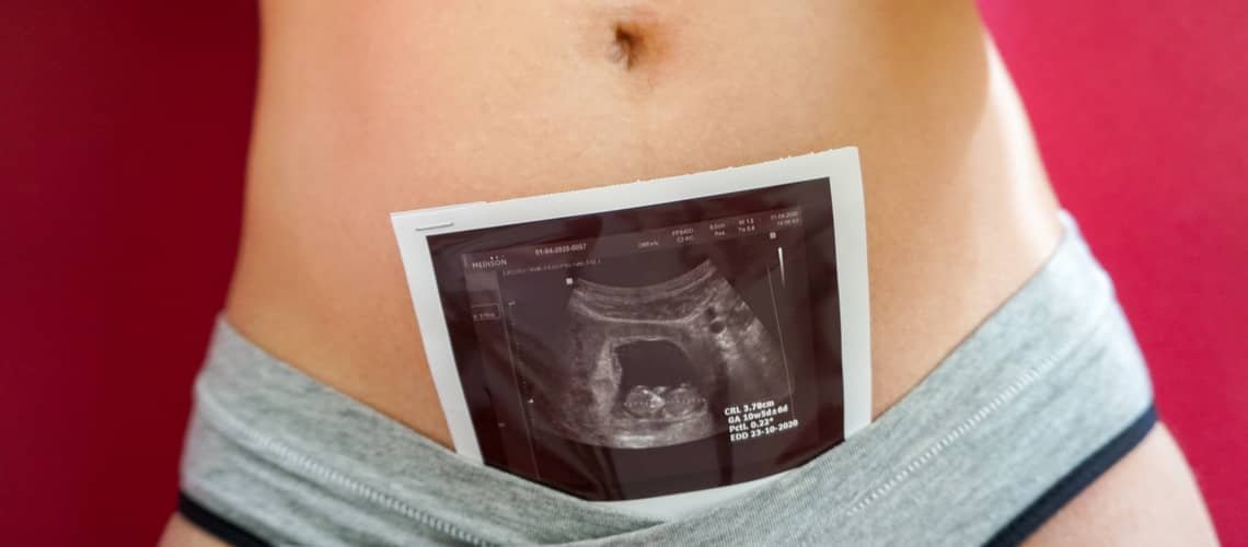 10. týždeň tehotenstva