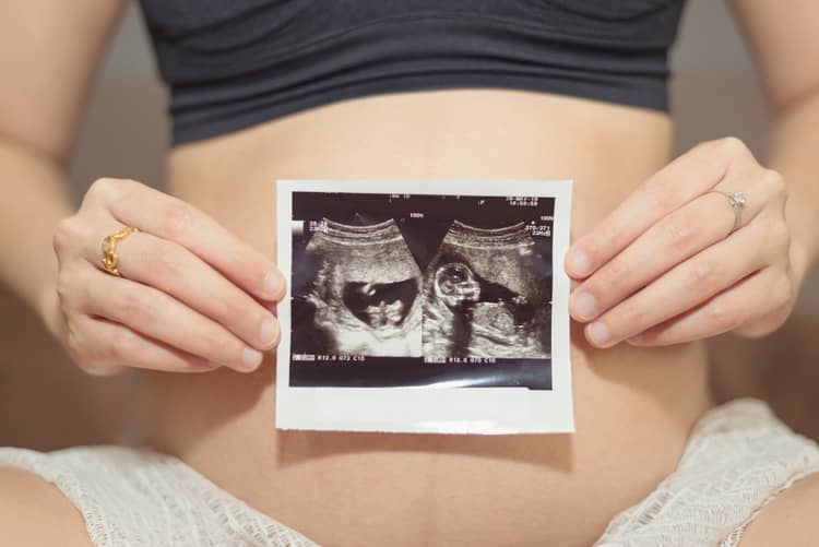 16. týždeň tehotenstva veľkosť plodu