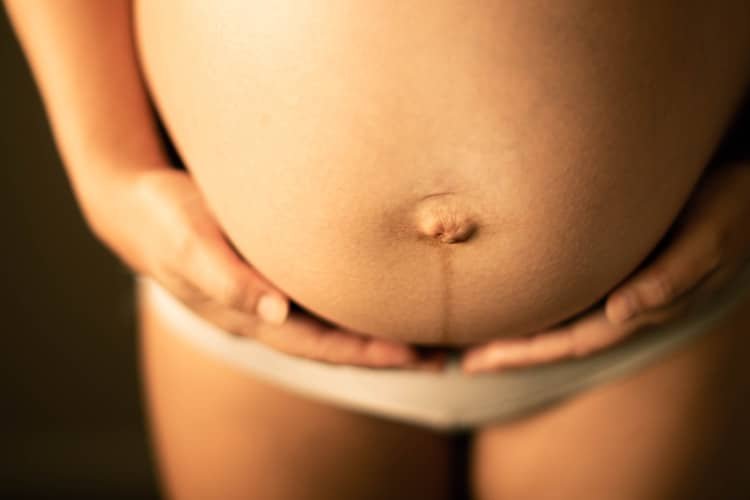 Diastáza v tehotenstve – príznaky