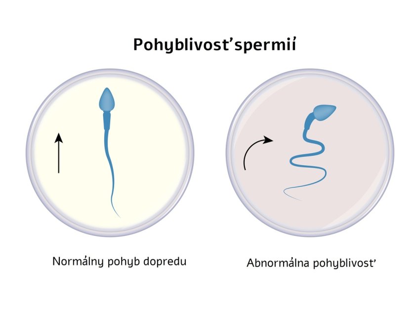 Pohyblivosť spermií