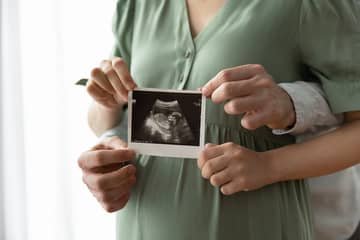 Morfologický ultrazvuk – čo to je, kedy sa robí, aká je cena