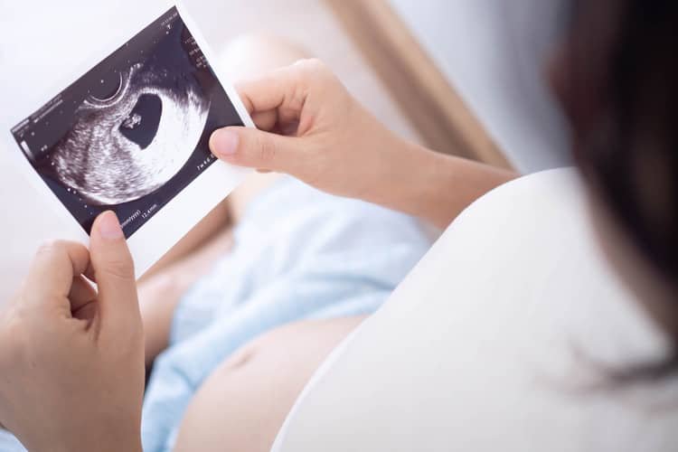 Kedy sa robí prvý ultrazvuk v tehotenstve?