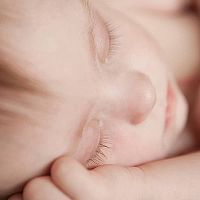 Príznaky Downovho syndrómu u novorodenca