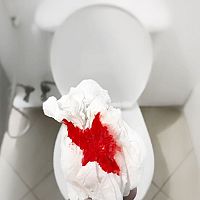 Krvná zrazenina pri potrate