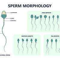 Morfológia spermií