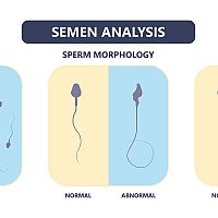 Spermiogram analýza semena